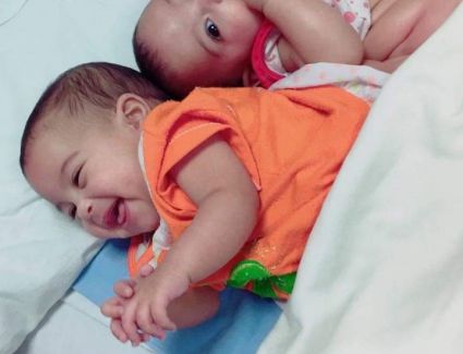      استجابت لجنة الاستغاثات الطبية بمجلس الوزراء لاستغاثة طلب إجراء عملية جراحية لفصل منطقتي الظهر والفخذ لتوأمتين ملتصقتين تبلغان من العمر 12 شهرا، تقيم أسرتهما في محافظة الدقهلية