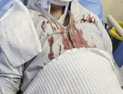 تعرض الفنان عبدلله التركماني لحادث مريع