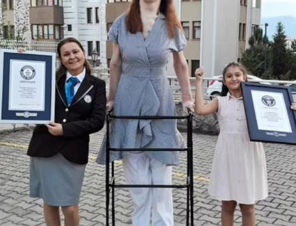 فتاة تلهم البشر لكيفية تقبل أنفسهم من خلال دخولها موسوعة جينيس للأرقام القياسية