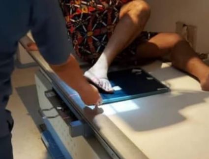 إصابة فنان مصري سقطَ عليه الديكور!