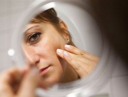 التغذية غير الصحية تظهر على الوجه