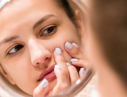 كريم سحري يزيل البثور في يوم واحد يدهش مستخدمي تيك توك