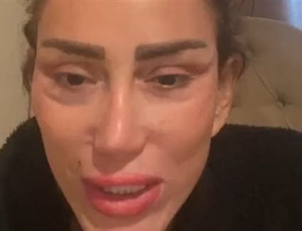 وجهها تشوه بالكامل.. هل يمكن مقاضاة طبيب ريهام سعيد؟